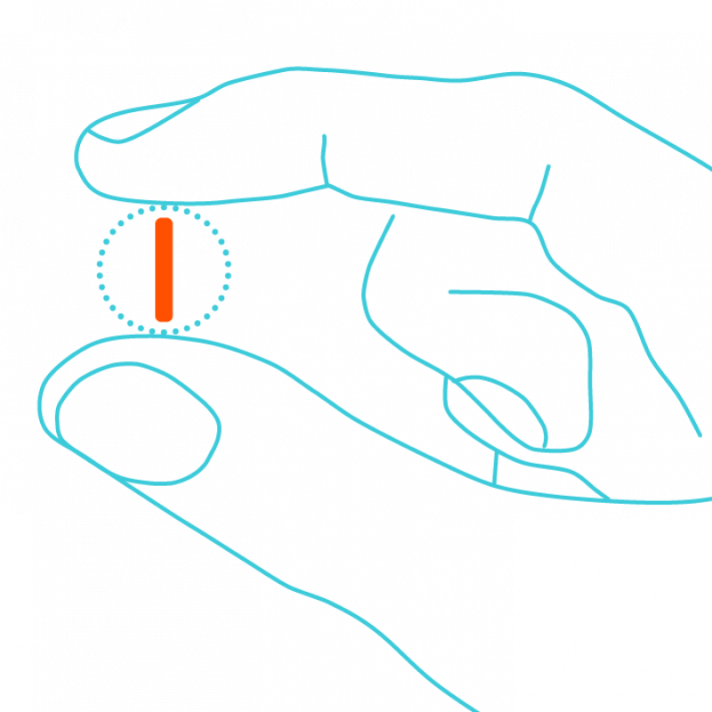Schematische Darstellung einer Hand mit Implantat von AMW